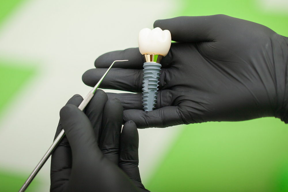 strong dental implant