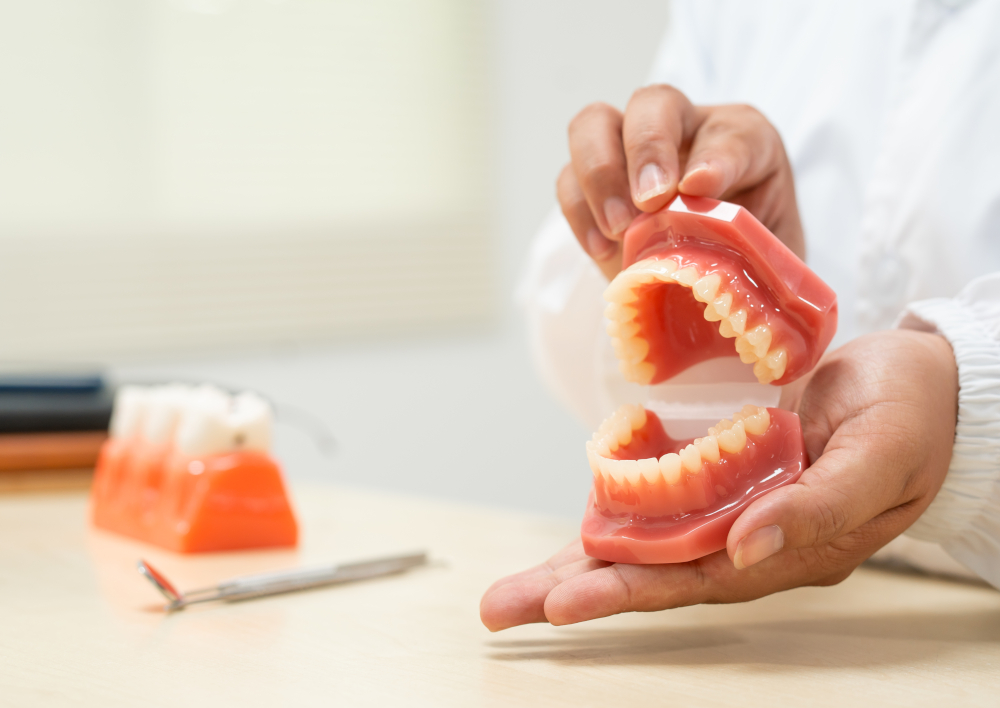 implants vs dentures